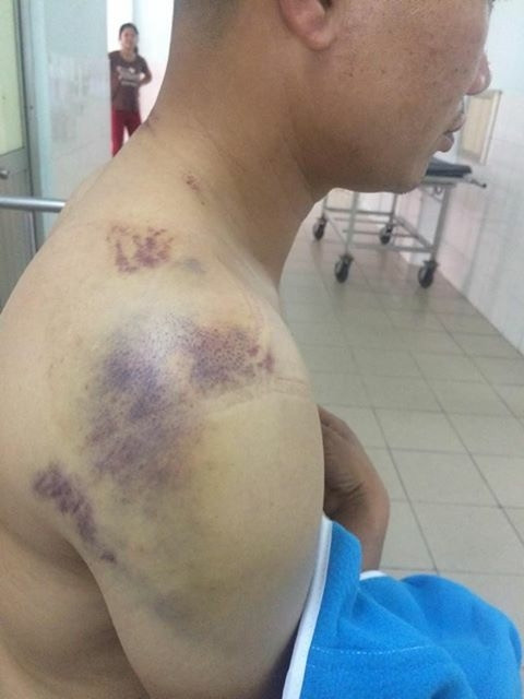 Lộ diện nghi phạm đánh lái xe bằng gậy sắt trên quốc lộ ảnh 1