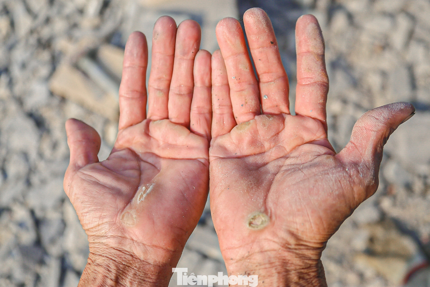Nắng nóng mồ hôi ra nhiều làm đôi bàn tay của anh Xâm đau rát không thể đục đá nhiều như trước. Nắng nóng mồ hôi ra nhiều làm đôi bàn tay của anh Xâm đau rát không thể đục đá nhiều như trước.