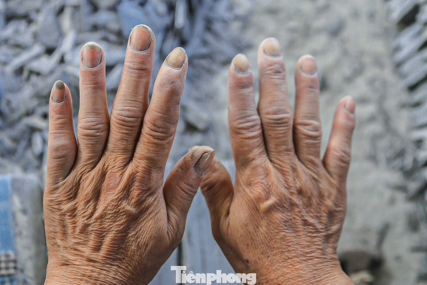 Nắng nóng mồ hôi ra nhiều làm đôi bàn tay của anh Xâm đau rát không thể đục đá nhiều như trước. Nắng nóng mồ hôi ra nhiều làm đôi bàn tay của anh Xâm đau rát không thể đục đá nhiều như trước.