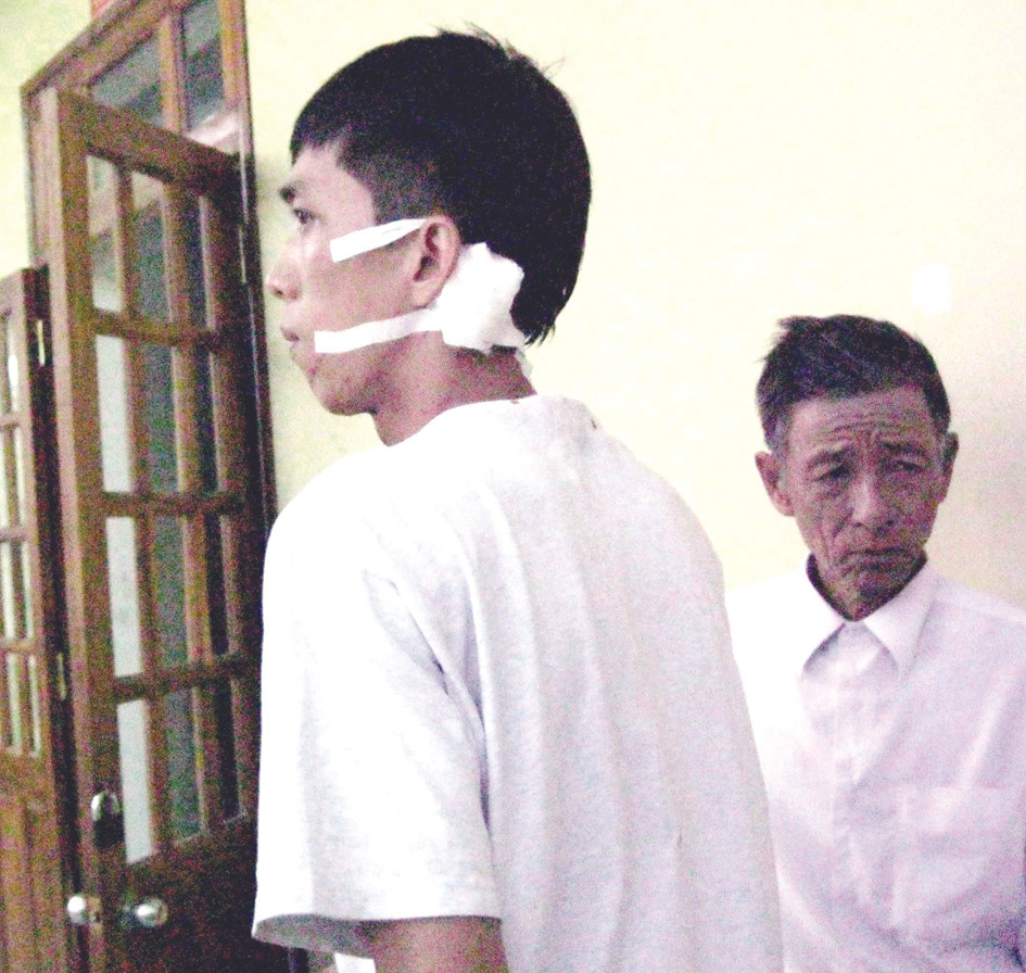 Anh Nguyễn Duy Sang với vết thương trên đầu vì bị dân đánh nhầm. Ảnh: N.T