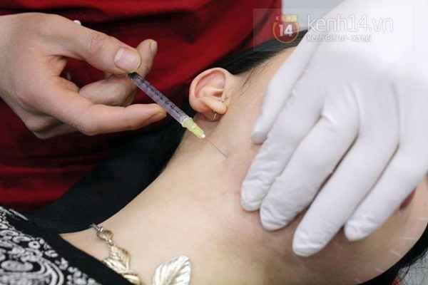 Tuy đã bôi thuốc tê nhưng Hạt Mít cũng khá đau, nhất là khi tiêm xuống bọng cằm, vùng da mỏng nhất. Bài viết: http://news.zing.vn/Theo-chan-hot-girl-Ha-Noi-di-tiem-nho-mat-tai-Han-Quoc-post378016.html Nguồn Zing News 