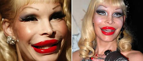 Amanda Lepore khiến người đối diện phải sợ hãi