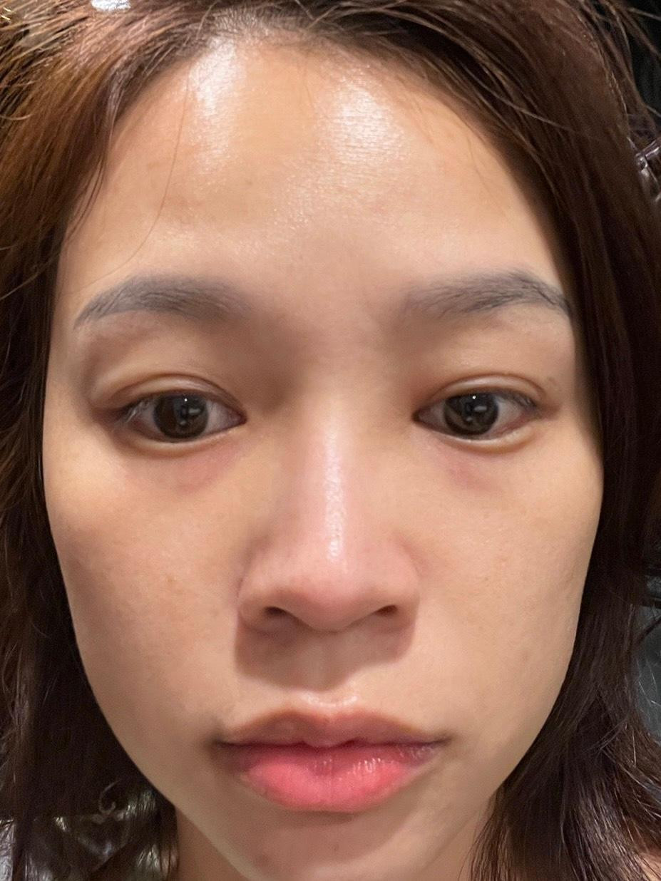 Sam bị dị ứng nặng sau khi tham gia phim kinh dị đầu tay.