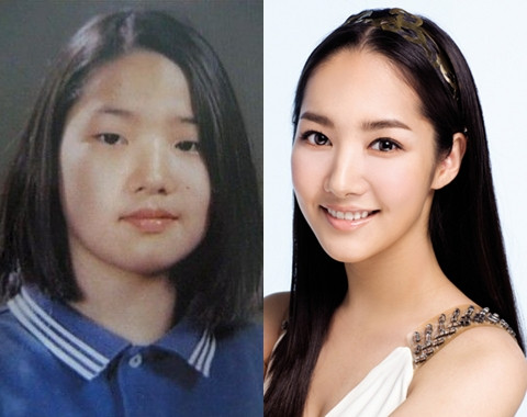 Park Min Young ngày ấy và bây giờ khác xa một trời một vực