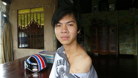 Lúc sinh ra, Trí đã không có 2 cánh tay như các em bé khác