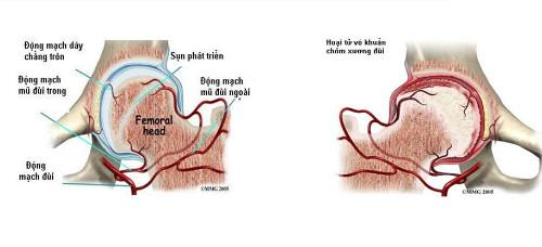cn-trong-hoai-tu-xuong-khi-tre-bat-ngo-di-dung-khap-khieng