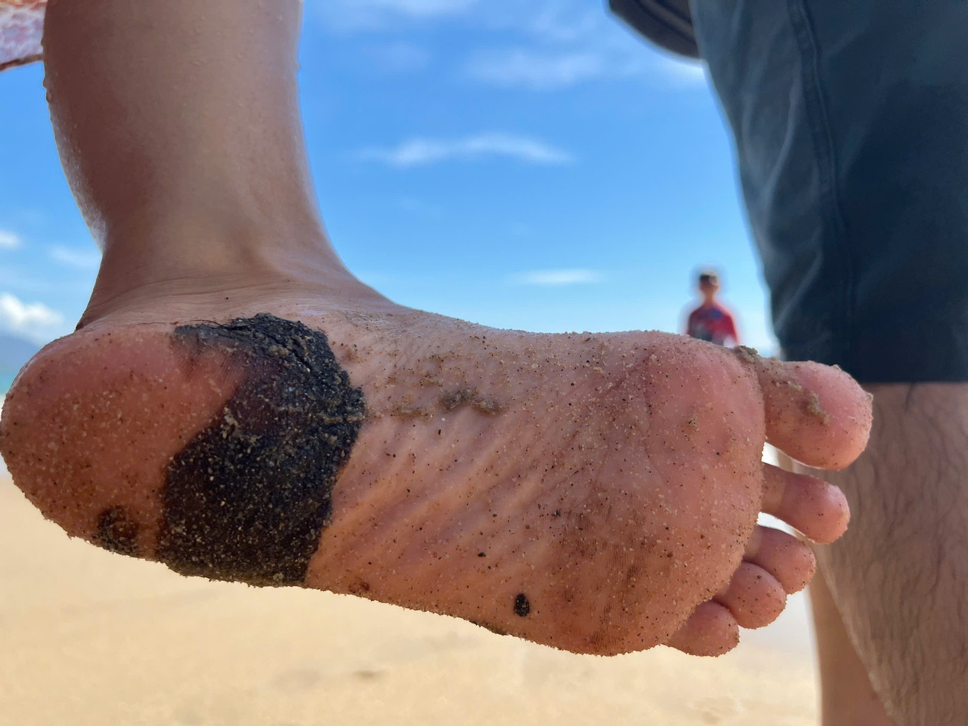 Nhiều du khách bị dầu nhớt dính đen đầy tay và chân. Ảnh: Thanh Thanh.