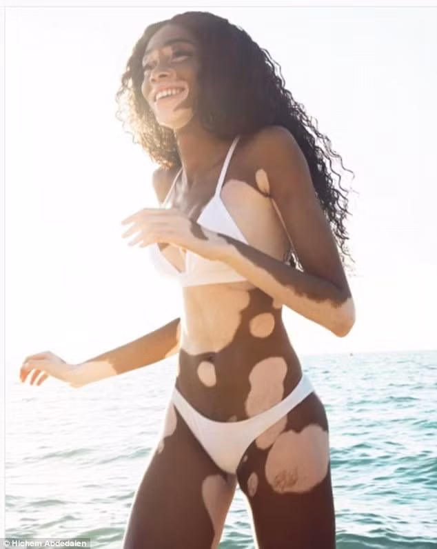 'Siêu mẫu hoang màu' Winnie Harlow đẹp tựa nữ thần trước hoàng hôn ảnh 3