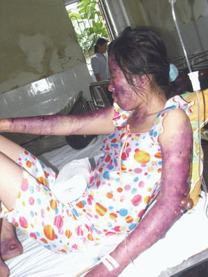 Những nạn nhân may mắn sống sót. Ảnh: Lam Khê. Những nạn nhân may mắn sống sót. Ảnh: Lam Khê