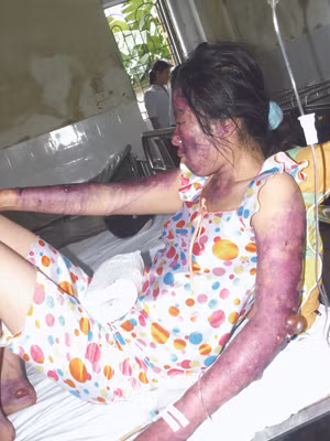 Những nạn nhân may mắn sống sót. Ảnh: Lam Khê