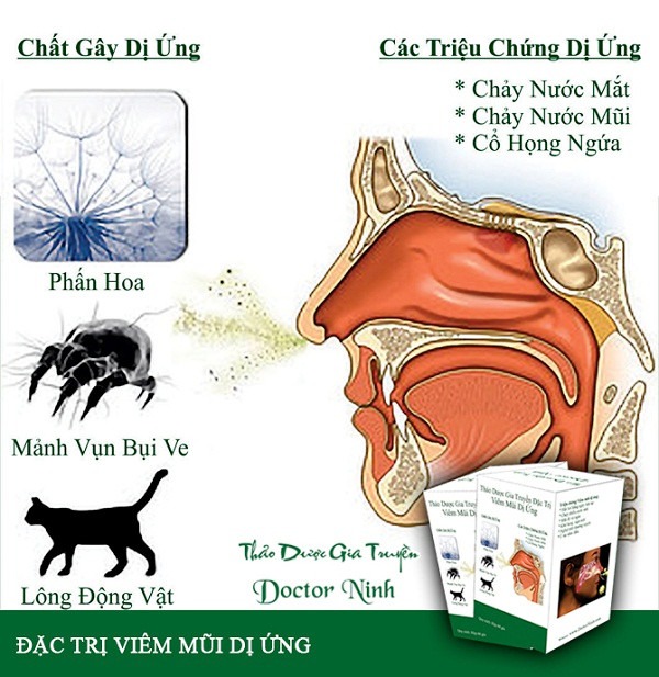 Cách chữa khỏi viêm mũi dị ứng trong 3 tuần ảnh 2