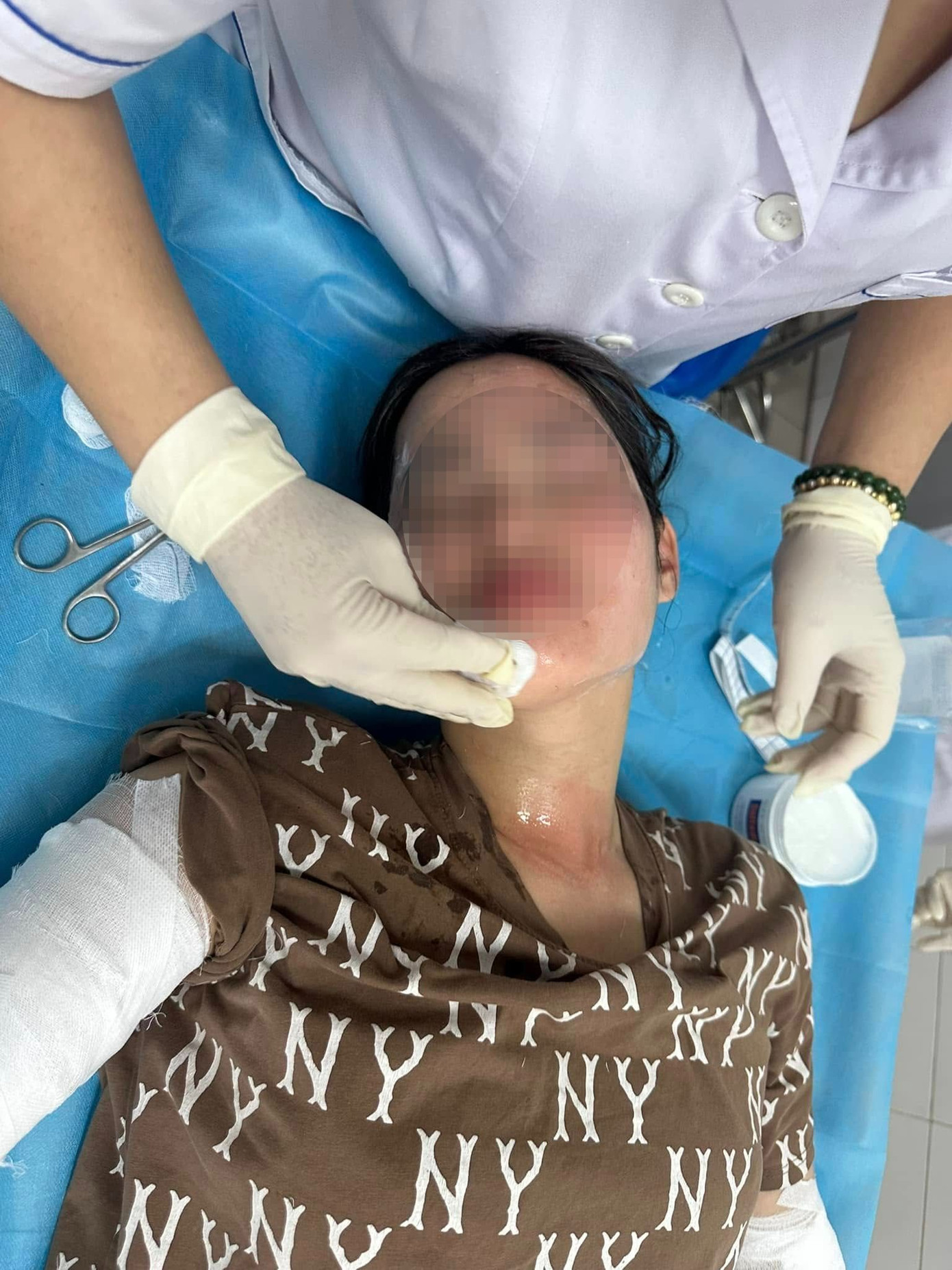 Sau vụ việc, chị Giang khuyến cáo mọi người nên cẩn thận khi sử dụng các loại bóng bay. Ảnh: Nhân vật cung cấp