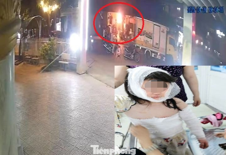 Hiện trường vụ phóng hỏa được camera ghi lại và hình ảnh bé gái đang điều trị tại bệnh viện