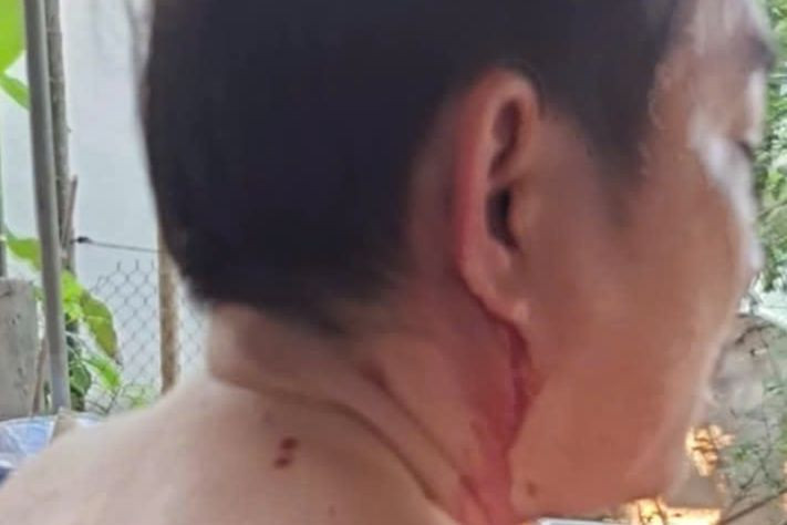 Hiện trường vụ việc (ảnh trên); Tang vật vụ án và nạn nhân (ảnh dưới).