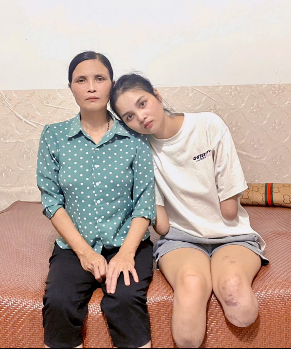 Bà Thúy là chỗ dựa vững vàng cho con gái. Ảnh: NVCC