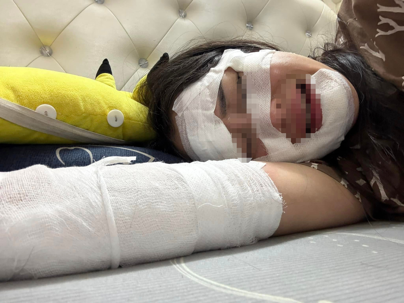 Sau vụ việc, chị Giang khuyến cáo mọi người nên cẩn thận khi sử dụng các loại bóng bay. Ảnh: Nhân vật cung cấp