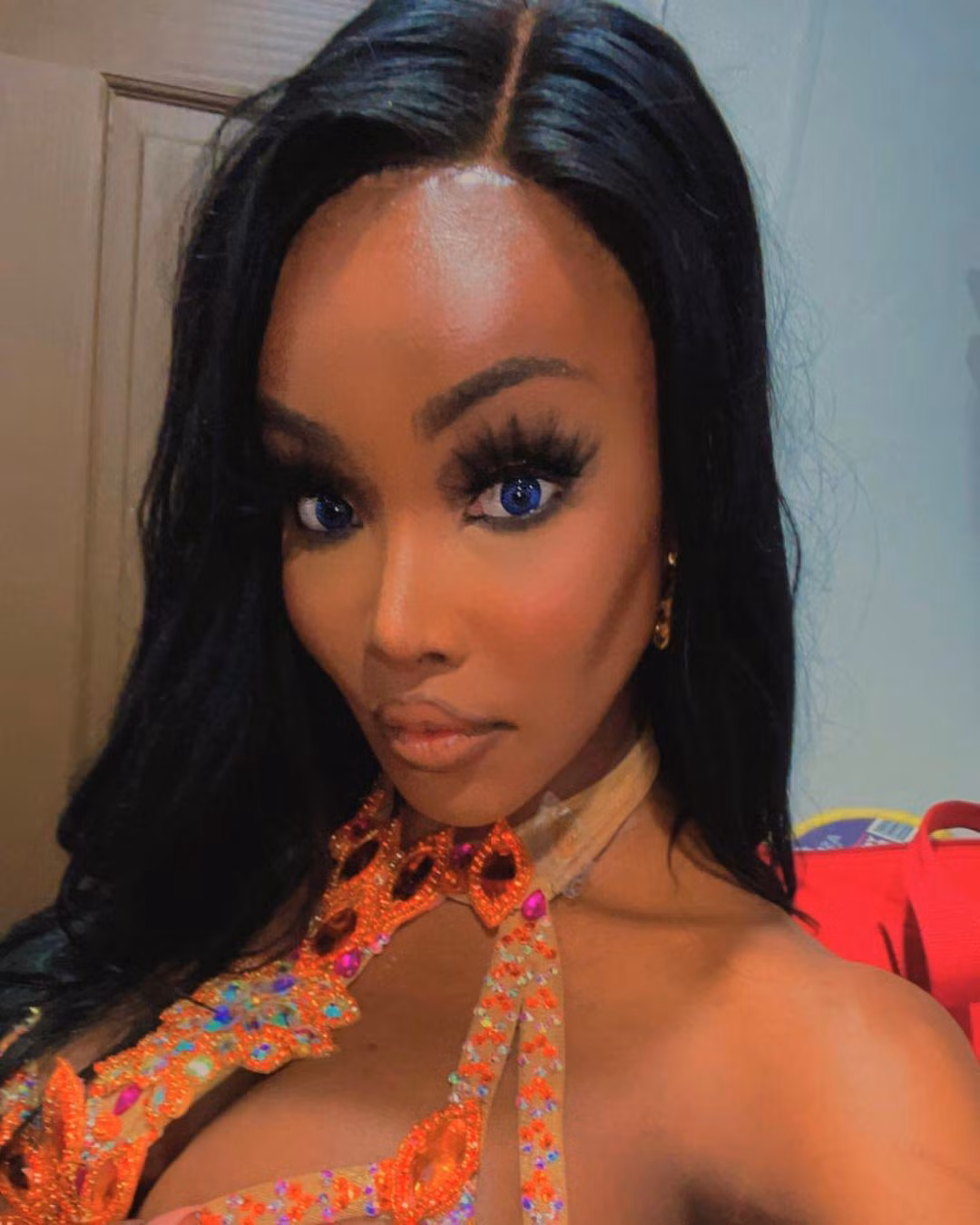 Jazell Barbie Royale khoe gương mặt mới sau khi phẫu thuật thẩm mỹ.
