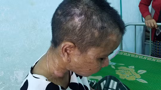 Tin mới nhất vụ nữ giúp việc 9X bị chủ tra tấn như thời trung cổ ảnh 5