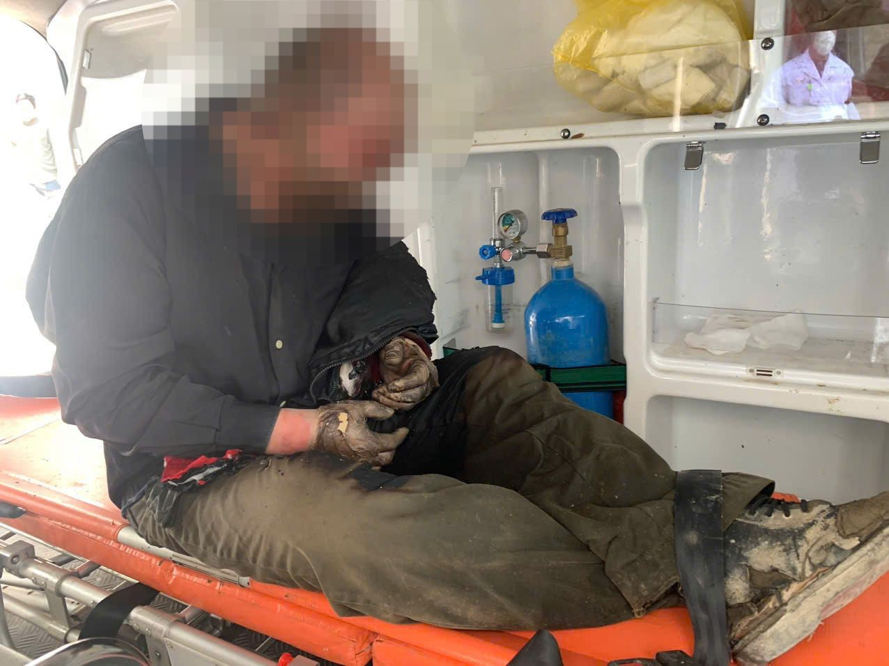 Sau khi được giải cứu, người đàn ông bị bỏng nặng do cháy xăng. Ảnh: Cắt từ clip