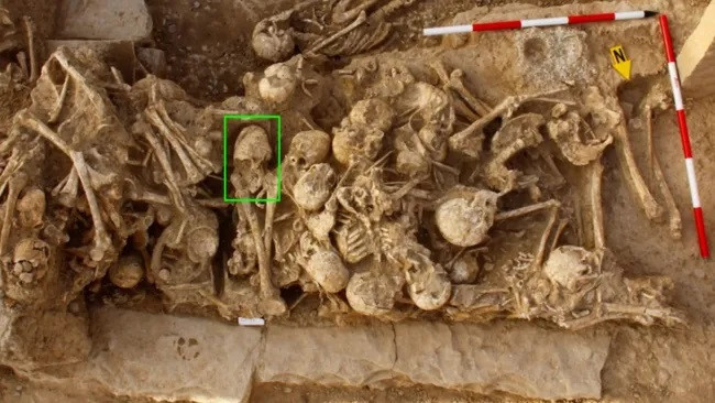 Một phụ nữ trẻ với hộp sọ được biến đổi đã được chôn cất cùng với những người khác tại một nghĩa trang thời tiền sử ở Iran. (Ảnh: Dự án thời tiền sử Zohreh)