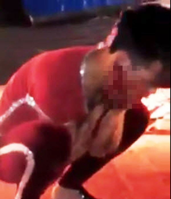 Kinh hãi, diễn viên xiếc bị cá sấu cắn rách mặt khi đang biểu diễn ảnh 1