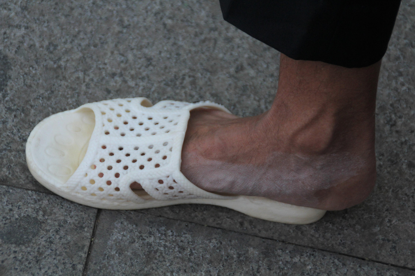 Bàn chân ông Hải hiện vẫn còn đau sau khi gắng sức thi đấu tại giải Quảng Bình Discovery Marathon 2021 một tuần trước.