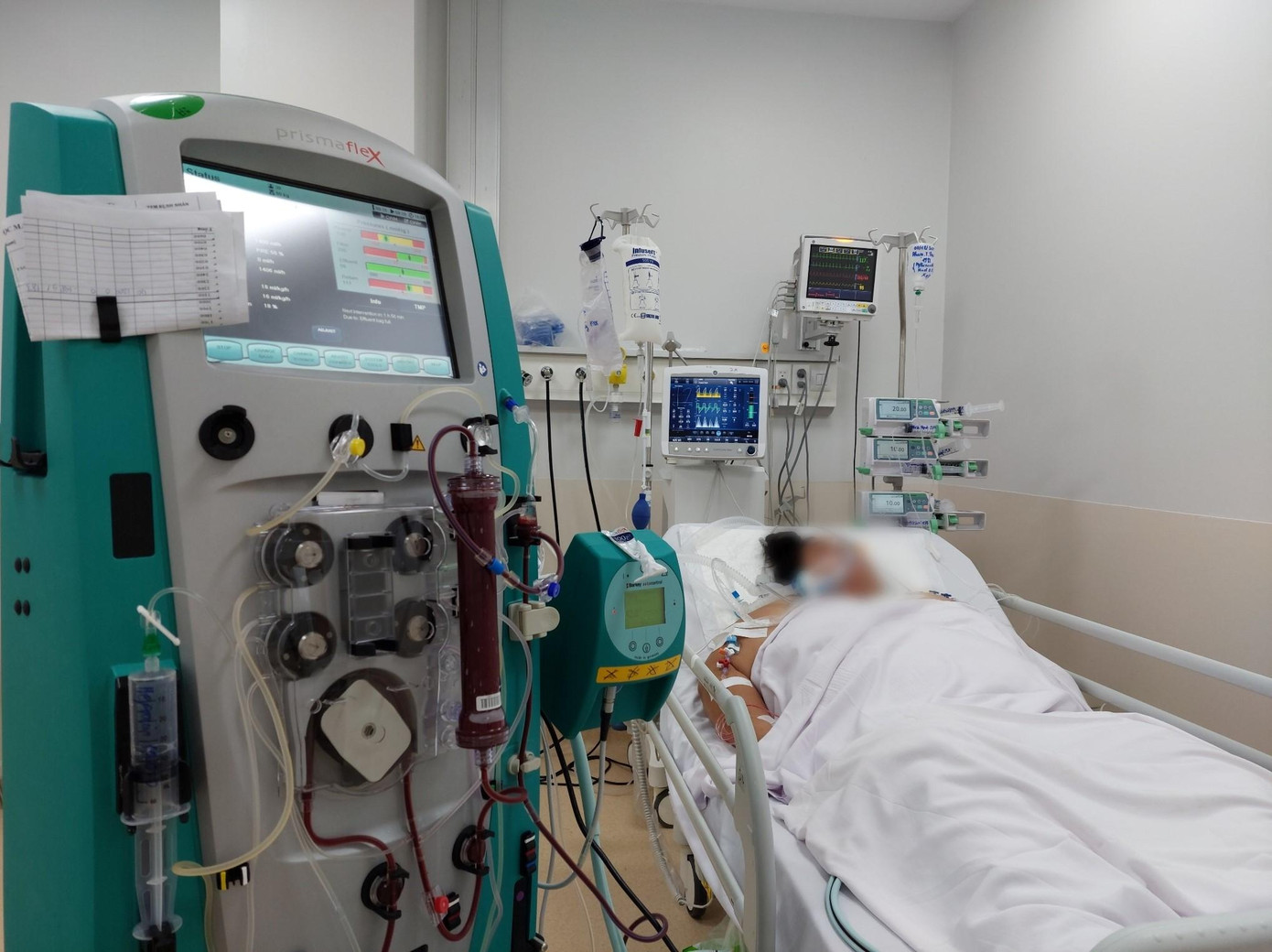 Bác sĩ Trần Hữu Chinh - Khoa Nội tim mạch Bệnh viện Chợ Rẫy cho biết: "Đây là ca có chuyển biến bệnh rất nặng dù đã tiêm 2 mũi vắc xin. Bệnh nhân này từ lúc mới nhập viện đã phải can thiệp thở máy và lọc thận liên tục được hơn 5 ngày mà tình trạng cũng không cải thiện nhiều”. Bác sĩ Trần Hữu Chinh - Khoa Nội tim mạch Bệnh viện Chợ Rẫy cho biết: "Đây là ca có chuyển biến bệnh rất nặng dù đã tiêm 2 mũi vắc xin. Bệnh nhân này từ lúc mới nhập viện đã phải can thiệp thở máy và lọc thận liên tục được hơn 5 ngày mà tình trạng cũng không cải thiện nhiều”.