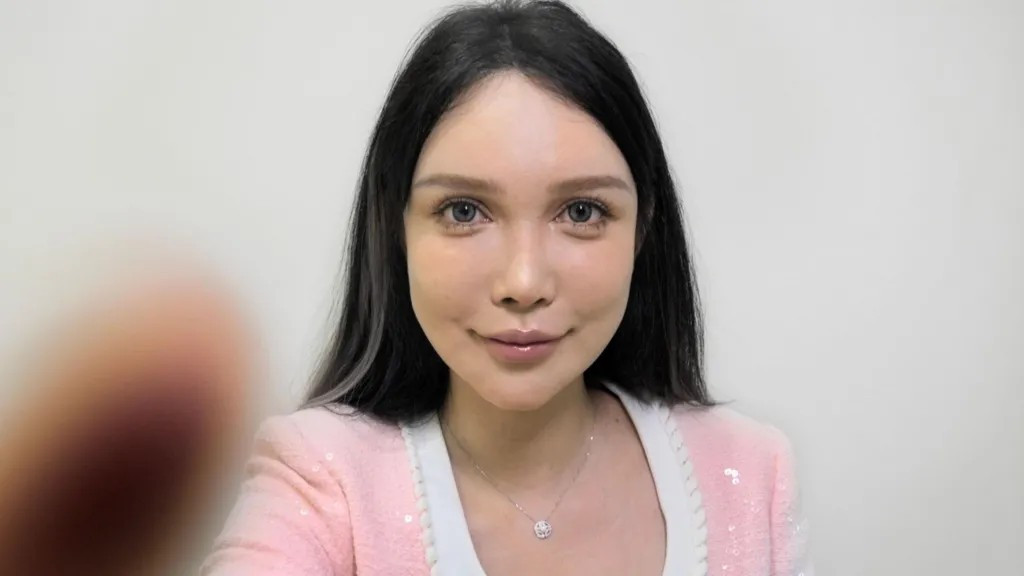 Cô Abby Wu, người đã trải qua hơn 100 ca phẫu thuật thẩm mỹ Cô Abby Wu, người đã trải qua hơn 100 ca phẫu thuật thẩm mỹ