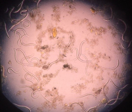 Coi chừng mất mạng vì nhiễm giun lươn ảnh 1