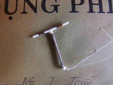 Chiếc vòng lấy ra từ ổ bụng chị Tuyền