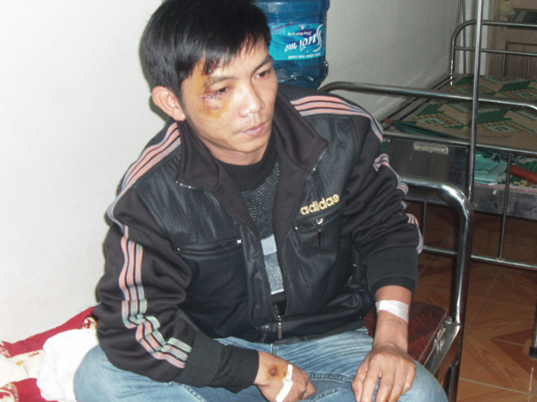 Cán bộ kiểm lâm Đào Công Thắng đang điều trị vết thương tại một bệnh viện tư nhân