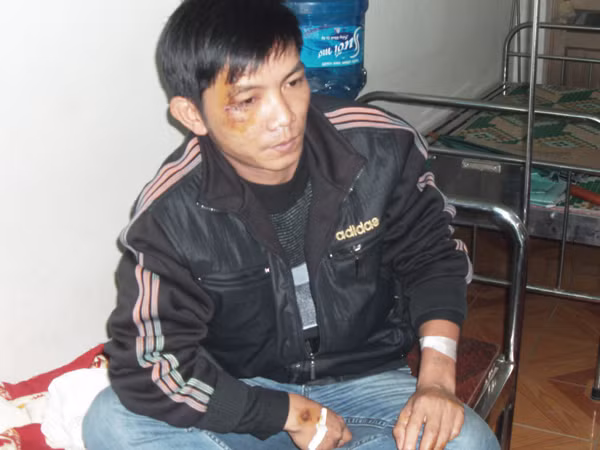 Cán bộ kiểm lâm Đào Công Thắng đang điều trị vết thương tại một bệnh viện tư nhân