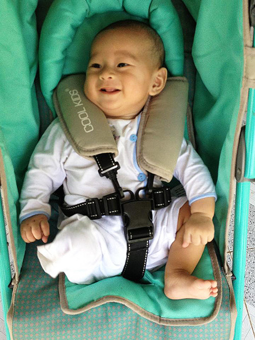 Gian nan tạo chân giả cho bé trai bị văng khỏi bụng mẹ ảnh 1