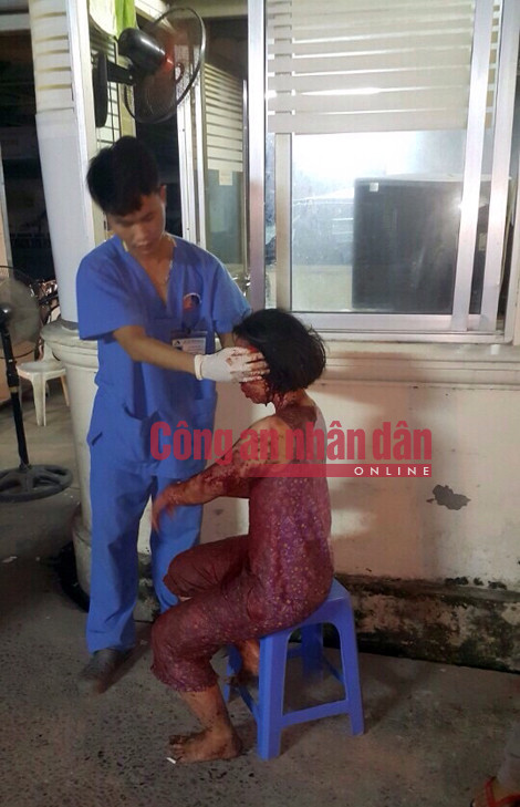 Nổ lớn tại ngõ Thông Phong, nhiều người thương vong ảnh 6