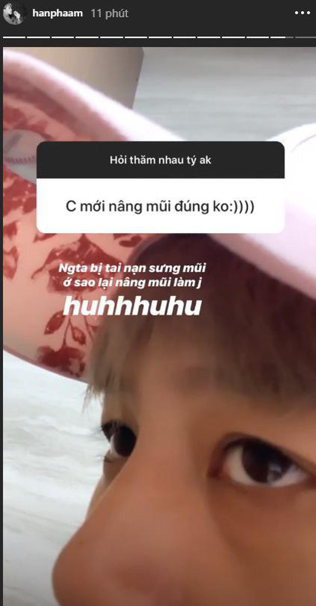 Mũi cao bất thường, Bảo Hân vướng nghi vấn ‘dao kéo’ ảnh 1