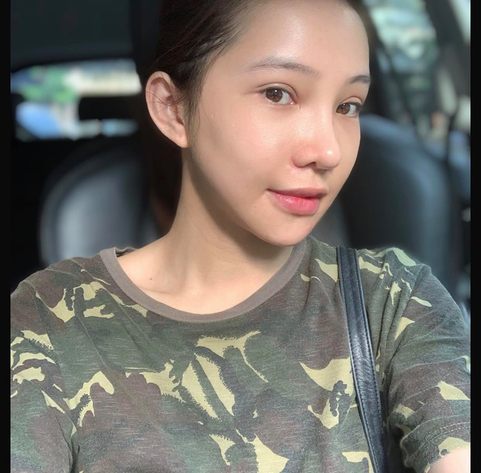 Lưu Đê Ly tung ảnh phẫu thuật biến dạng, công khai 'đập mặt' níu kéo tuổi xuân ảnh 6