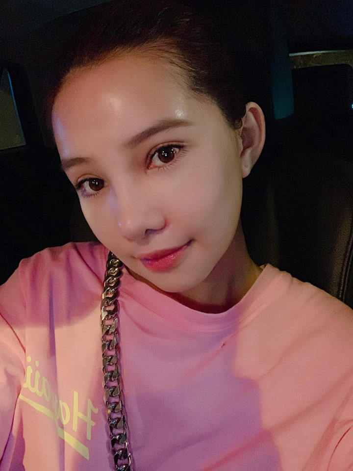 Lưu Đê Ly tung ảnh phẫu thuật biến dạng, công khai 'đập mặt' níu kéo tuổi xuân ảnh 4