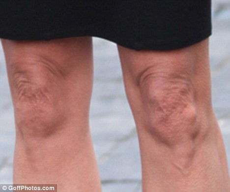 Tuy nhiên, dấu hiệu tuổi tác thì đã lộ rõ trên chiếc đầu gối của cựu siêu mẫu