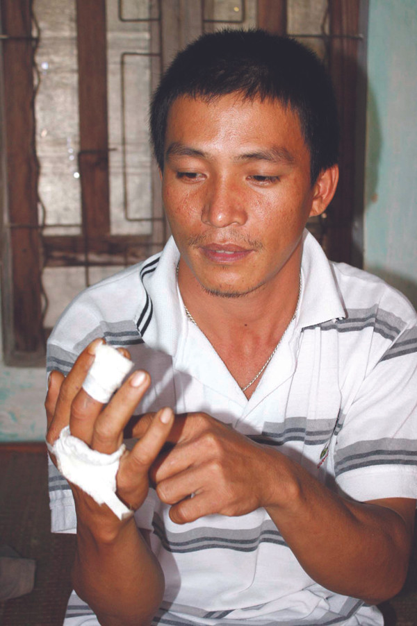 Anh Lý và vết thương