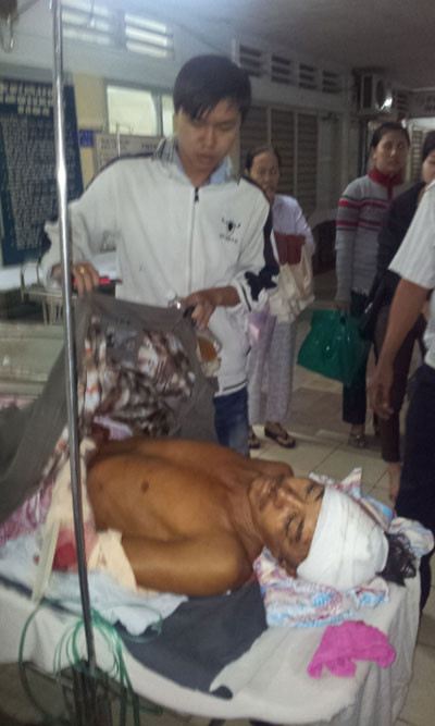 Ông Hùng bị nứt sọ vùng chẩm