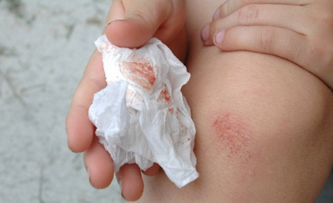 Vi rút HIV sống được bao lâu khi ở ngoài cơ thể? ảnh 1