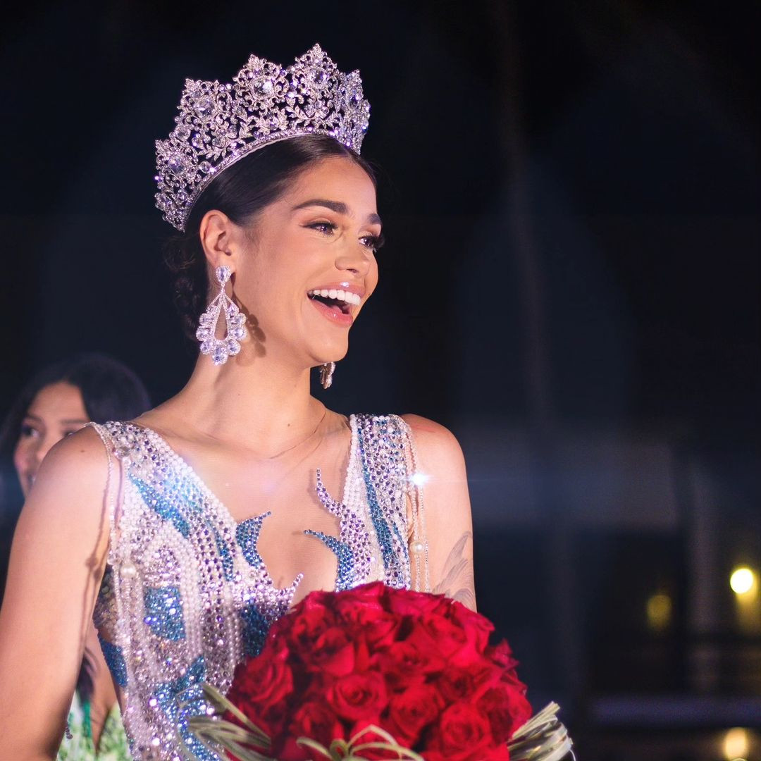 Nguyên nhân của sự thay đổi này vì cuộc thi Miss Charm 2024 công bố địa điểm tổ chức tại Mỹ. Nhiều khán giả dự đoán Anna Blanco gặp khó khăn trong việc xin visa sang Mỹ để thi Miss Charm 2024. Không chỉ Venezuela, nhiều quốc gia cũng thay đổi đại diện thi Miss Charm 2024 vì vấn đề visa.