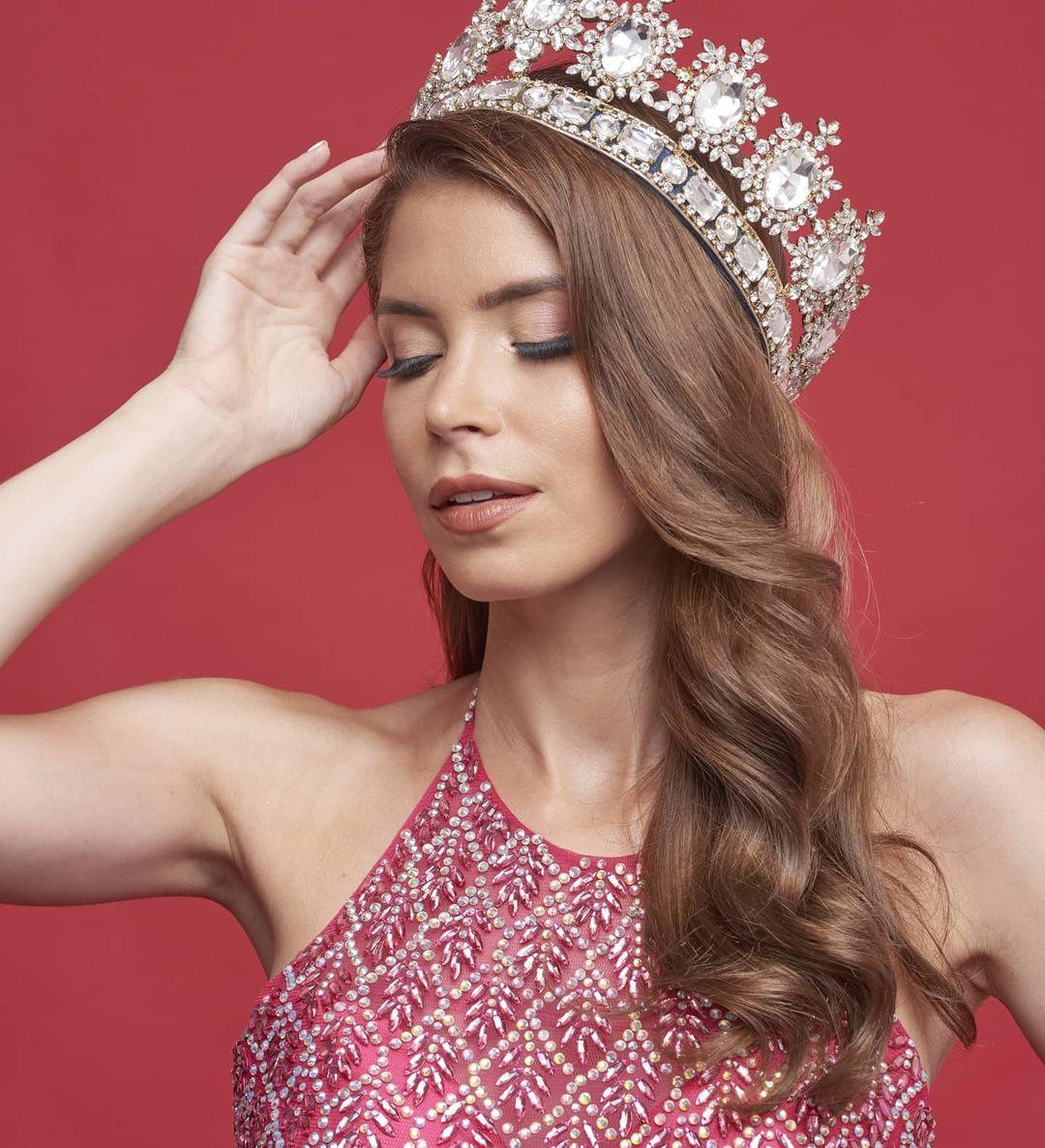 Kể từ đó đến nay, sân chơi Miss Universe mở rộng cửa chào đón các người đẹp chuyển giới. Santos Biccò được đánh giá là thí sinh ấn tượng của cuộc thi năm nay với chiều cao nổi trội và nhan sắc quyến rũ.