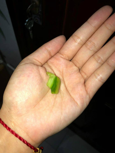 Bé gái 15 tháng suýt chết vì miếng dưa chuột bố đưa ảnh 1