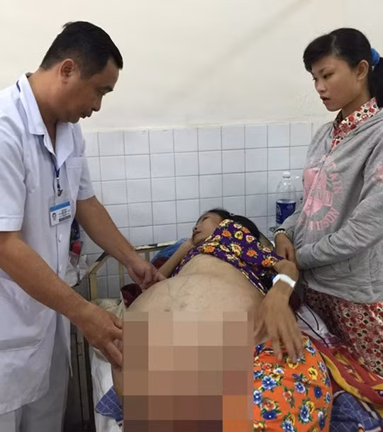Bệnh nhân P.T.T.M với khối u bướu 40 kg trước khi mổ