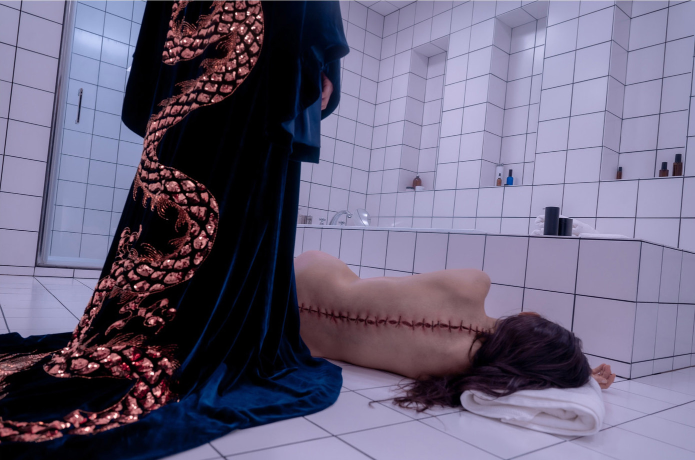 Vết thương dọc xương sống của Elisabeth sau khi sinh ra Sue Vết thương dọc xương sống của Elisabeth sau khi sinh ra Sue