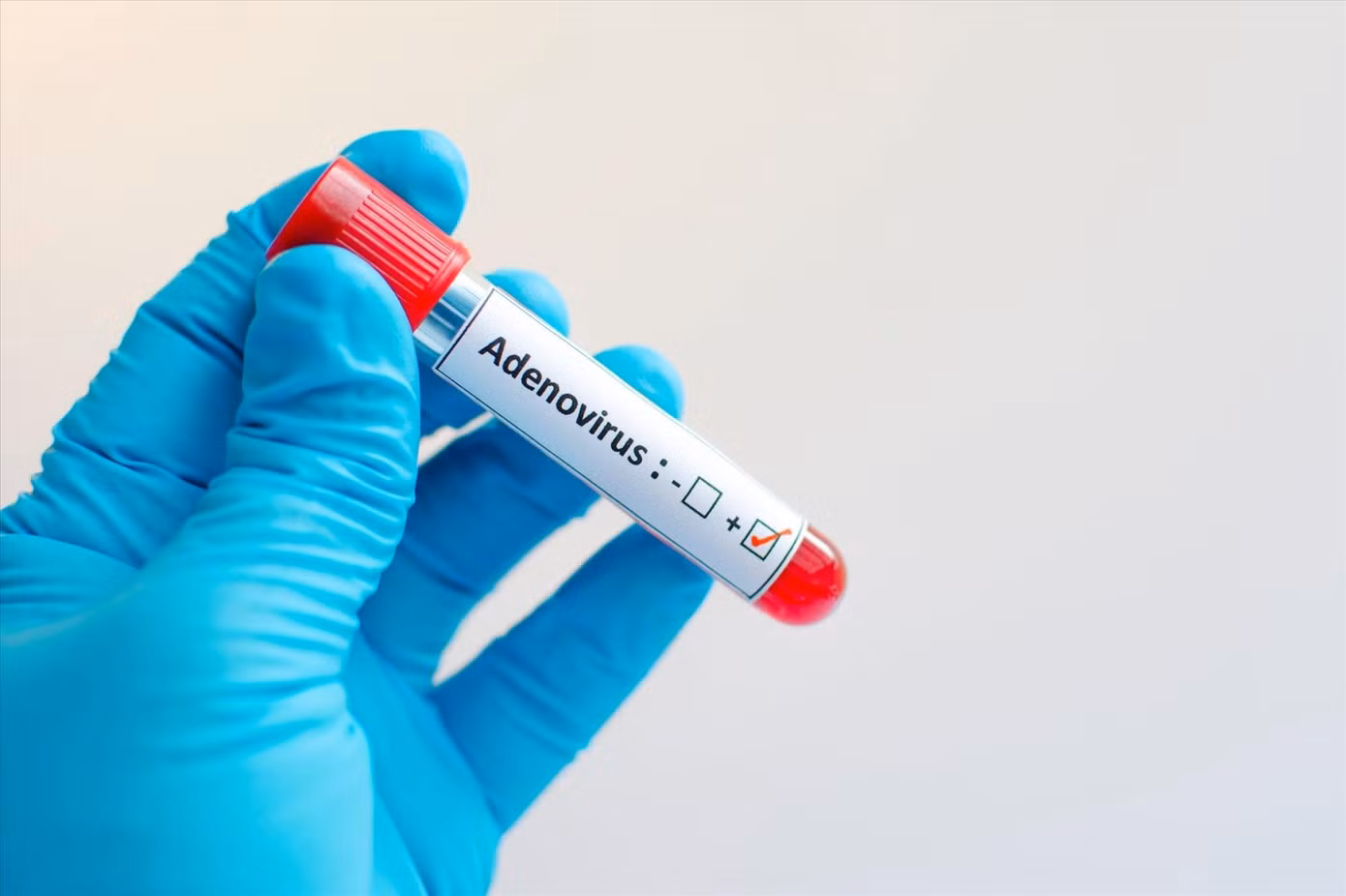 Xét nghiệm máu tìm bệnh viêm gan do Adenovirus