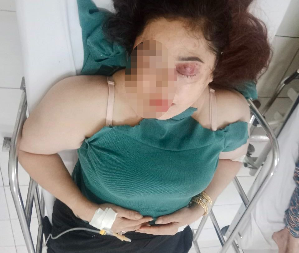 Chị Lan đang phải nằm viện cấp cứu sau khi bị nhóm người lạ hành hung. Ảnh: L.H.