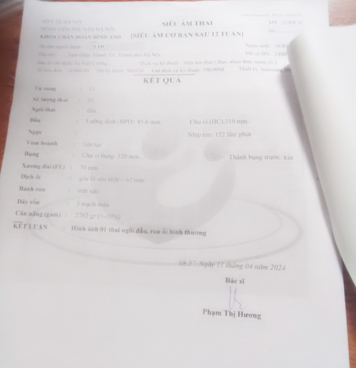 Kết quả siêu âm của bé Y. ngày 11/4/2024