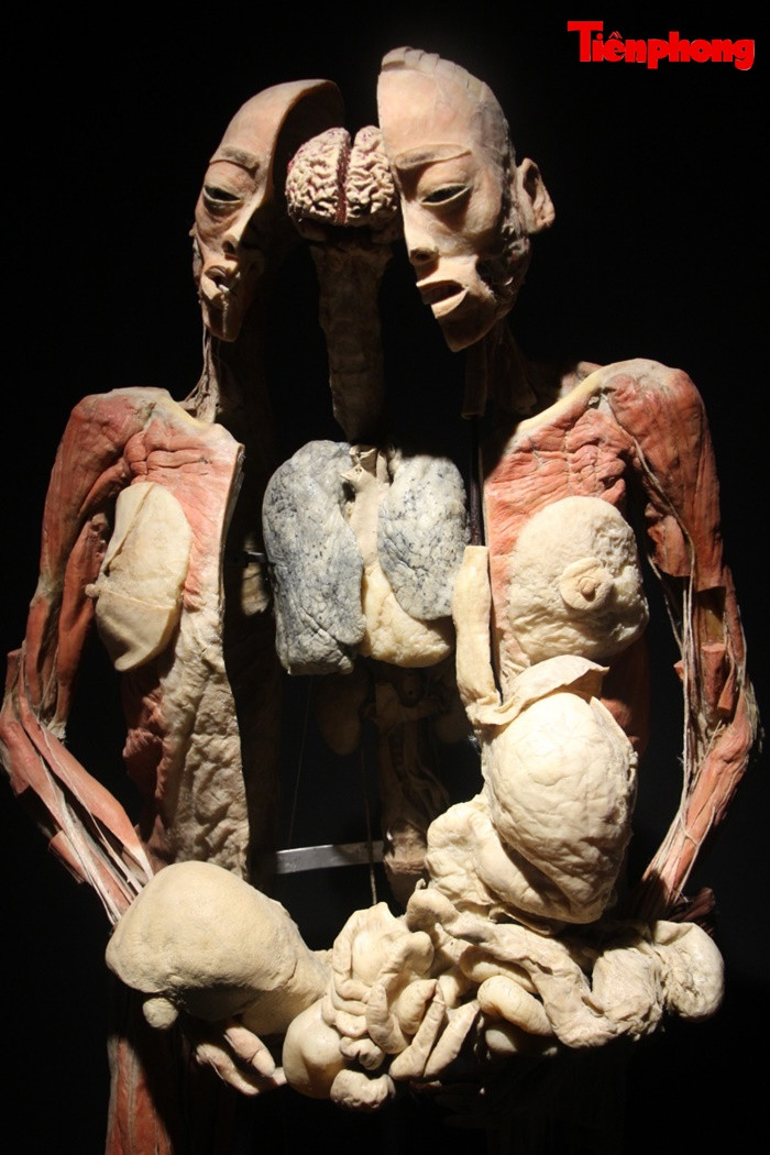 Triển lãm xác người ở TPHCM: Về phương diện y khoa thì rất ý nghĩa ảnh 2